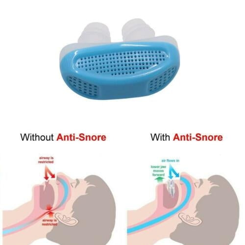 Dispositivo anti-ronco em silicone – azul para noites tranquilas